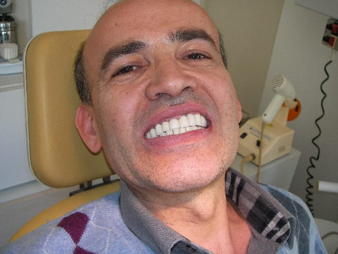Slider image (5) Istanbul Dental Healthcare